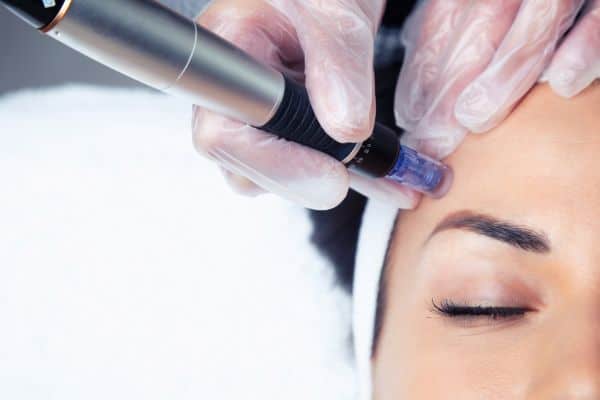 Explaining Total Skin Tightening Treatment and What to Expect 2 What Skin Concerns Can Total Skin Tightening Treatment Help With Sunbury?